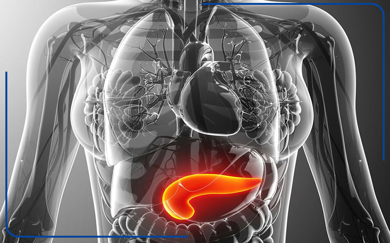 اختلال در عملکرد سلول‌های پانکراس